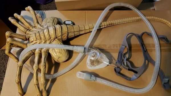 Potret Ketika Alat CPAP Diubah Jadi Alien Facehugger