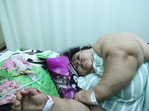 Berbobot 148 Kg, Sunarti Mengaku Konsumsi Obat Steroid Berbobot 148 Kg, Sunarti Mengaku Konsumsi Obat Steroid
