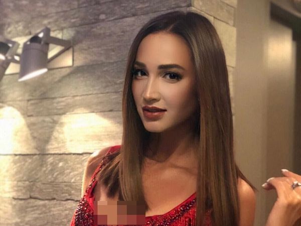 Foto: Penyanyi Cantik Rusia yang Masuk Rumah Sakit karena Berbikini di Salju