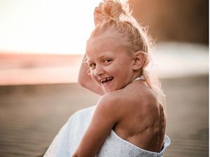 Kisah Menyentuh Ibu Saat Anaknya Malu Punya Bekas Luka Kanker