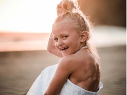 Kisah Menyentuh Ibu Saat Anaknya Malu Punya Bekas Luka Kanker