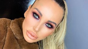 Foto: DJ Seksi Kecanduan Operasi Plastik, Pasang Implan di Kaki Biar Tinggi