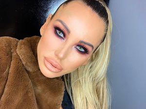 Foto: DJ Seksi Kecanduan Operasi Plastik, Pasang Implan di Kaki Biar Tinggi