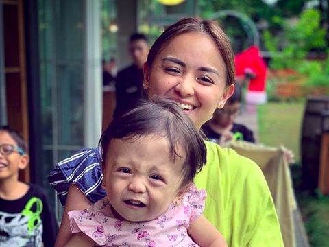 Alasan Joanna Alexandra Terbuka Ceritakan Penyakit Langka Anaknya
