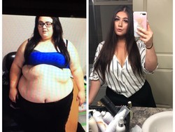 Transformasi Drastis Wanita yang Sulit Bernapas dengan Berat 171 Kg