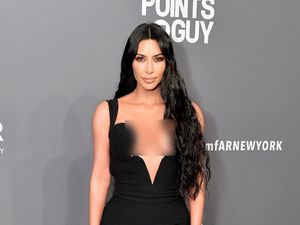 Kim Kardashian Dikritik karena Tutupi Kulit Sunburn dengan Foundation