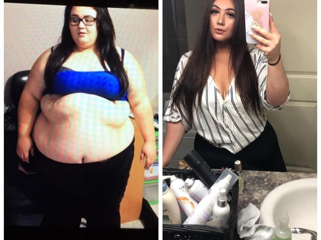 Potret Perjalanan Diet Wanita Pangkas 82 Kg, Bangkit dari Keterpurukan Potret Perjalanan Diet Wanita Pangkas 82 Kg, Bangkit dari Keterpurukan