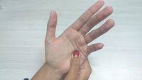 Semalam Tidur Tak Nyenyak? Pijatan di Titik Ini Bisa Redakan Insomnia
