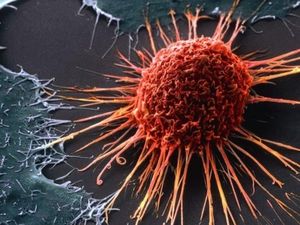 Ditemukan Obat Baru Efektif Sembuhkan Pasien Kanker Stadium Lanjut