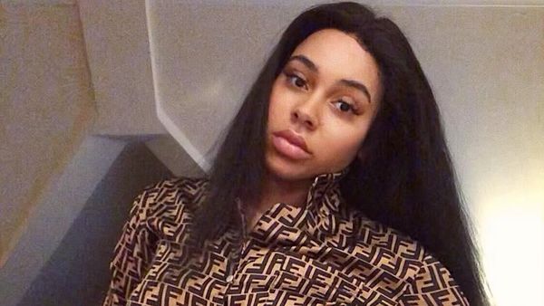 Potret Chelsea, Wanita yang Jadi Model Berkat Punya Stretch Mark