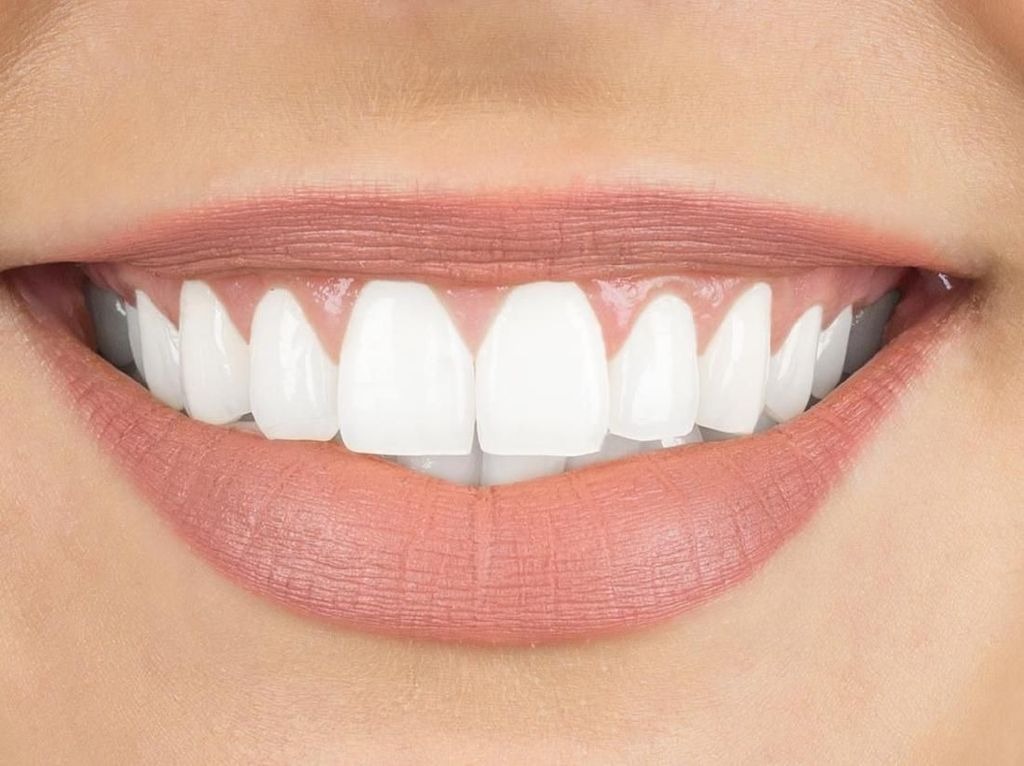 17 Cara Memutihkan Gigi Kuning Secara Alami