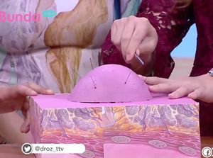 Waspada Bun, Bahaya Mencabut Rambut Halus di Payudara