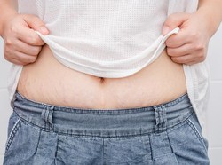 Kista Ovarium Sebesar 18 Kg Tumbuh di Perut Wanita Ini Sampai Sulit Napas