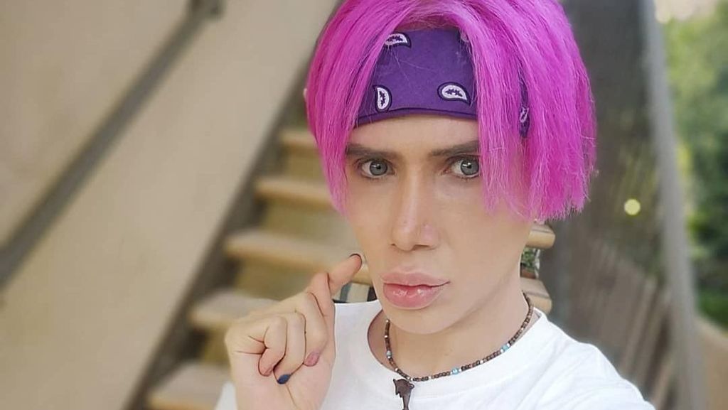 Transformasi Pria Bule yang Oplas Rp 1,5 Miliar Demi Mirip Personel BTS Transformasi Pria Bule yang Oplas Rp 1,5 Miliar Demi Mirip Personel BTS