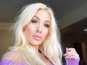 Foto Before-After Esktrem Wanita yang Operasi Plastik Selama 21 Tahun