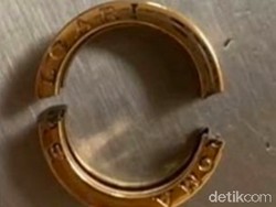 Menggemuk, Cincin Rp 23 Juta Terpaksa Dipotong dari Jari Wanita Ini