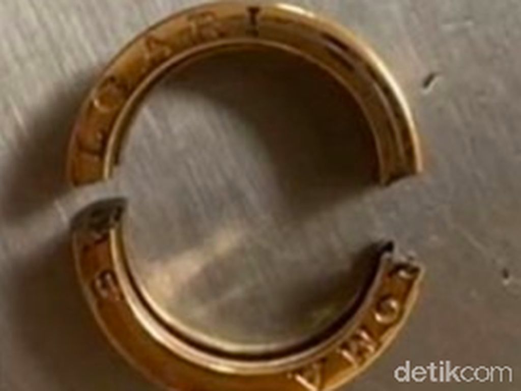 Menggemuk, Cincin Rp 23 Juta Terpaksa Dipotong dari Jari Wanita Ini Menggemuk, Cincin Rp 23 Juta Terpaksa Dipotong dari Jari Wanita Ini