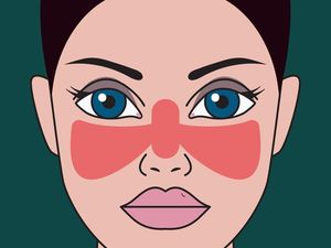 Mengenal Penyakit Lupus, Gejala, Penyebab, Pencegahan, dan Pengobatannya