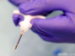 Derita Hudia Kena Rabies hingga Meninggal Dunia Usai Digigit Anjing