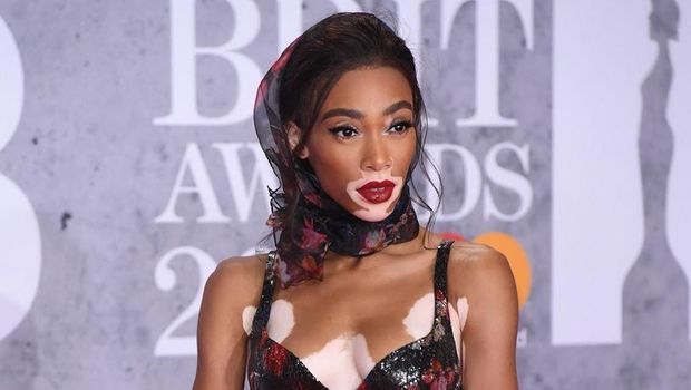 Winnie Harlow