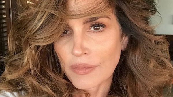 10 Artis Ngaku Terang-terangan Suntik Botox dan Filler, Begini Wajah Mereka