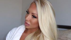 Perubahan Wanita yang Dulu Nangis Saat Bercermin, Kini Disebut Mirip Barbie