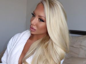 Perubahan Wanita yang Dulu Nangis Saat Bercermin, Kini Disebut Mirip Barbie