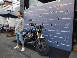 Sempat Terpuruk Pita Suaranya Rusak, Omesh Kini Jalani Hidup Sehat