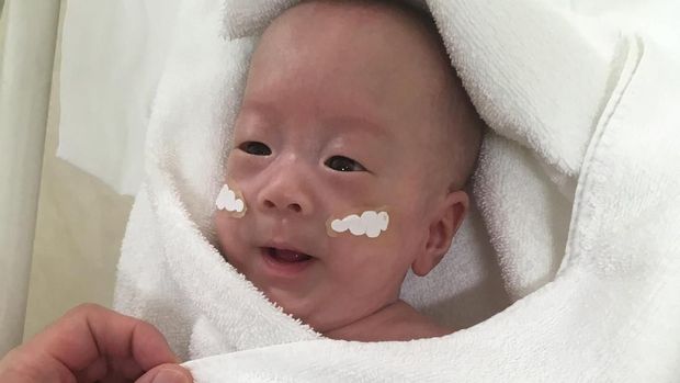 Bayi Terkecil di Dunia, Terlahir Hanya Seukuran Telapak Tangan