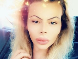 Pria Ini Kecanduan Botox Agar Mirip Barbie Hidup, Habiskan Rp 240 Juta