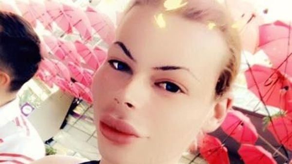 Penampilan Pria yang Kecanduan Botox Agar Mirip Barbie, Jadi Seram