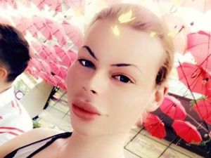 Penampilan Pria yang Kecanduan Botox Agar Mirip Barbie, Jadi Seram Penampilan Pria yang Kecanduan Botox Agar Mirip Barbie, Jadi Seram