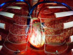 Wisata ke Dalam Tubuh Manusia, Seperti Apa?