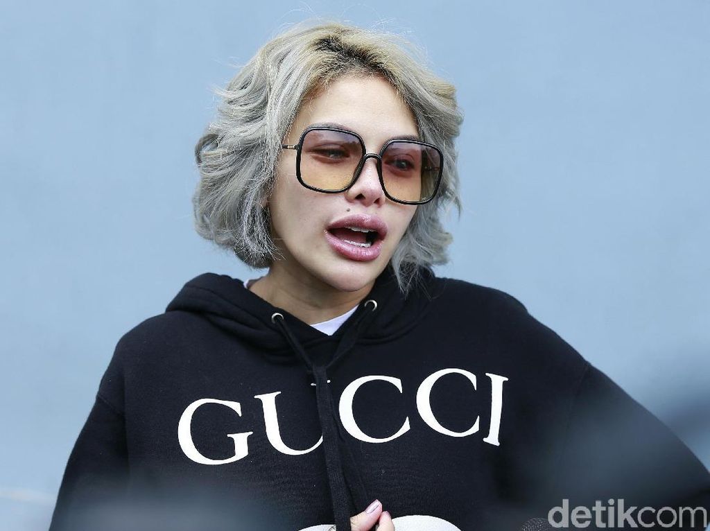 Ini Alasan Nikita Mirzani Operasi Hidung Rp 1,1 Miliar Ini Alasan Nikita Mirzani Operasi Hidung Rp 1,1 Miliar