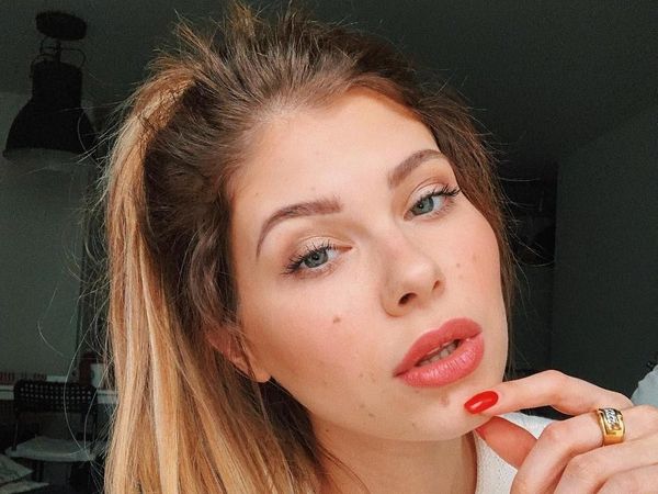 Foto: Selebgram Cantik yang Diejek Sapi Kotor karena Punya Tanda Lahir