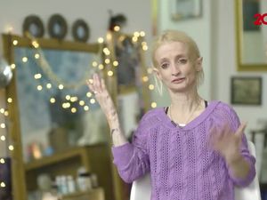 Idap Penyakit Langka, Wanita Ini Menua dengan Cepat
