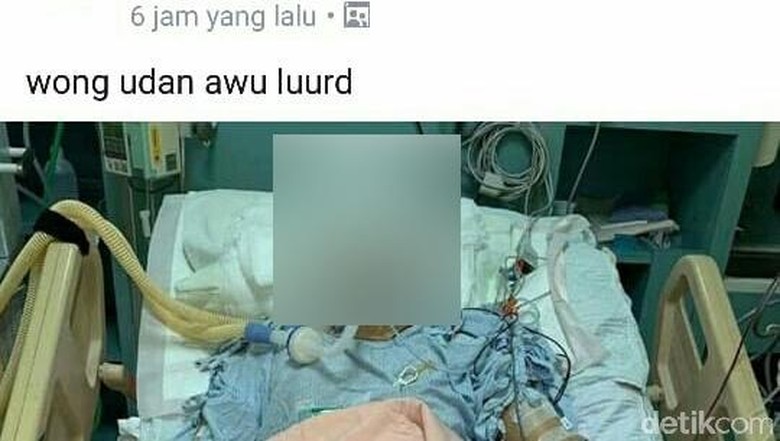 Rambut Panjang Terlilit Mesin, TKI Taiwan Asal Blitar Jalani Operasi