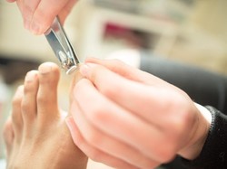 Urusan Motor Wakil Rakyat PDIP Berujung Cabut Kuku Kaki