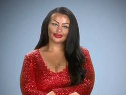 Kecanduan Operasi Plastik, Wanita Ubah Aerola Payudara Jadi Bentuk Hati