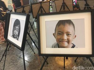 Bayi Tabung Bisa Jadi Cara Aman Cegah Risiko Penyakit Langka pada Anak