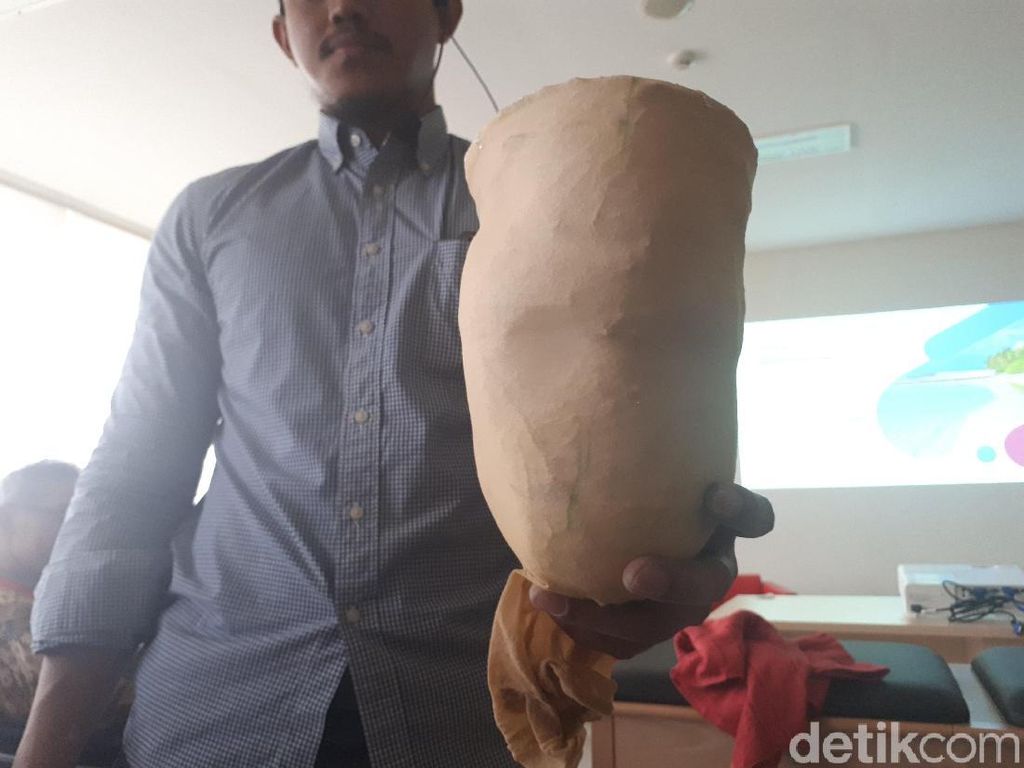 Berbagai Pertimbangan Sebelum Pasang Kaki Prostetik Berbagai Pertimbangan Sebelum Pasang Kaki Prostetik