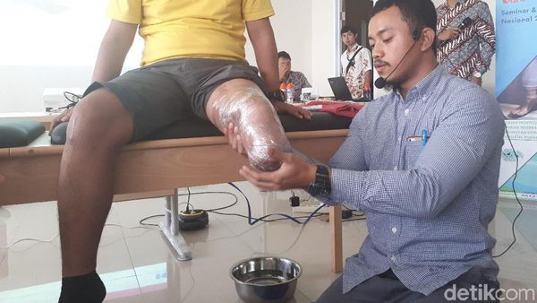 Foto: Begini Proses Pembuatan Kaki Prostetik
