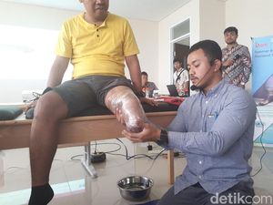 Foto: Begini Proses Pembuatan Kaki Prostetik