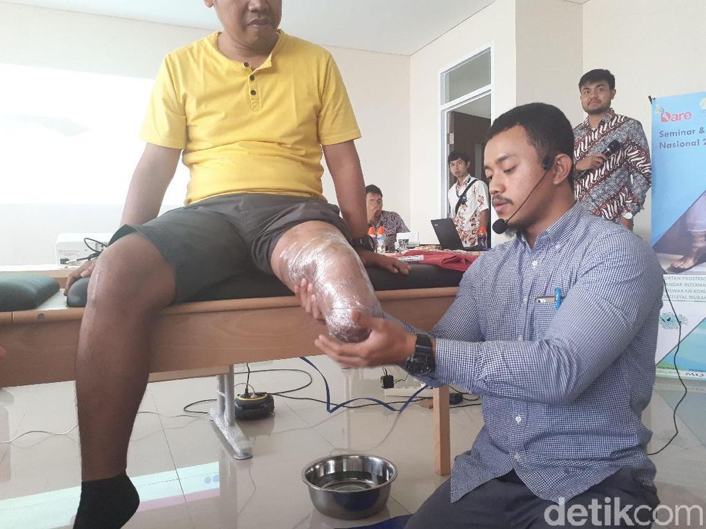 Foto: Begini Proses Pembuatan Kaki Prostetik Foto: Begini Proses Pembuatan Kaki Prostetik