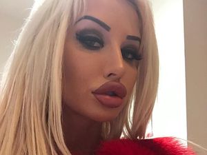 Punya Dada Jumbo dan Bibir Tebal, Wanita Ini Disumpahi Cepat Mati