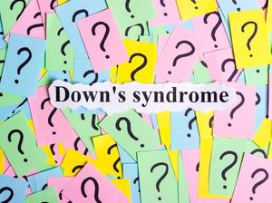 Pakar Biostatistika Ungkap Kasus Sindrom Down  5.000 Tahun Lalu Pakar Biostatistika Ungkap Kasus Sindrom Down  5.000 Tahun Lalu