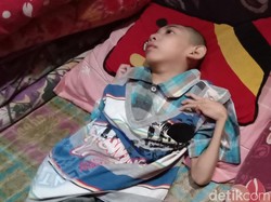 Kisah Rizky, Pengidap Pengecilan Otak yang Divonis Tak Bisa Sembuh