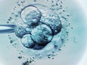 Diduga Selundupkan Embrio Manusia, Pria Malaysia Ditangkap di India