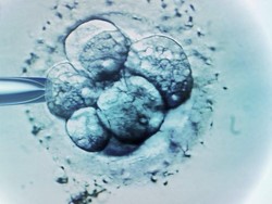 Diduga Selundupkan Embrio Manusia, Pria Malaysia Ditangkap di India