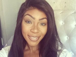 Perdana, Kontes Kecantikan Wanita dengan Bekas Luka Digelar di Inggris